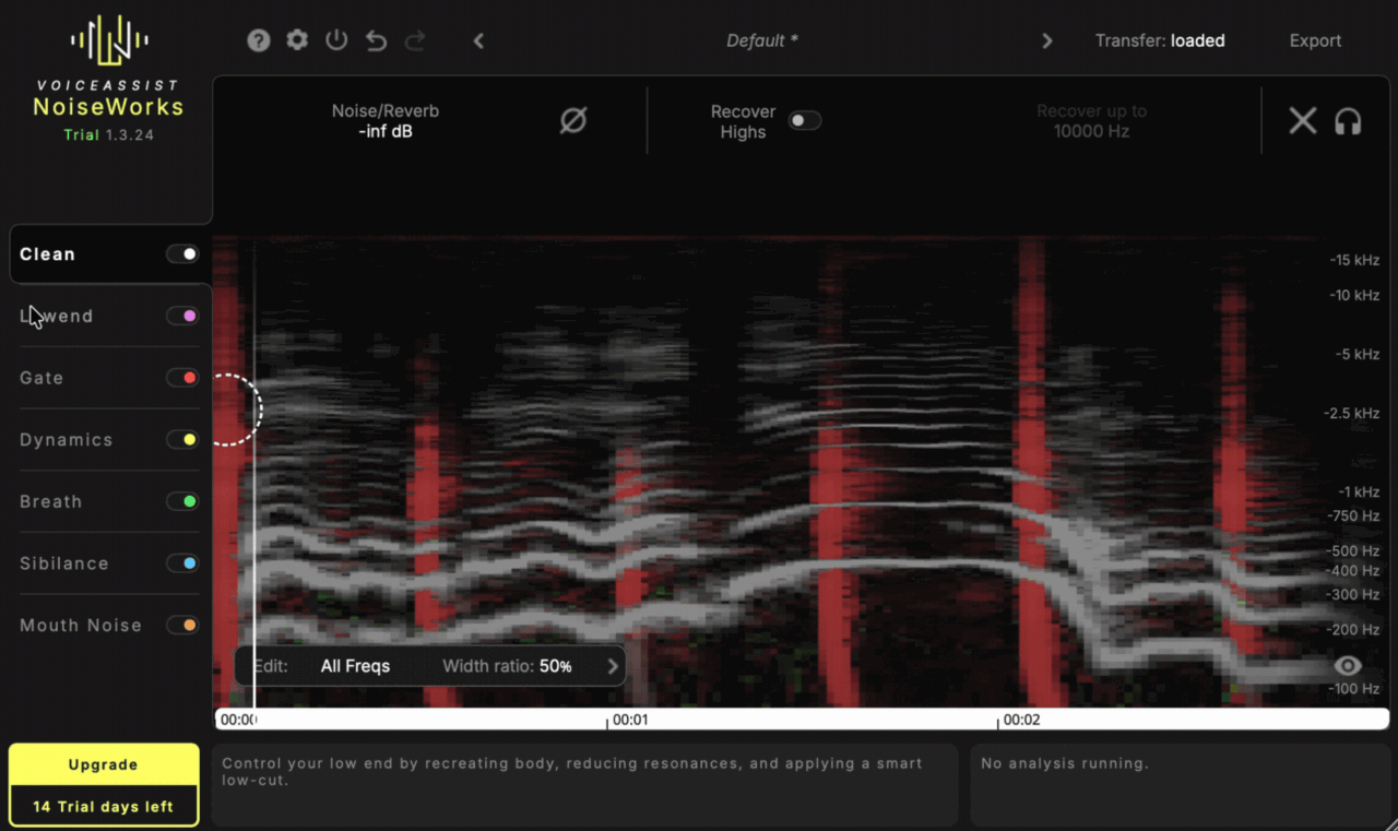 Noiseworks VoiceAssist Sections